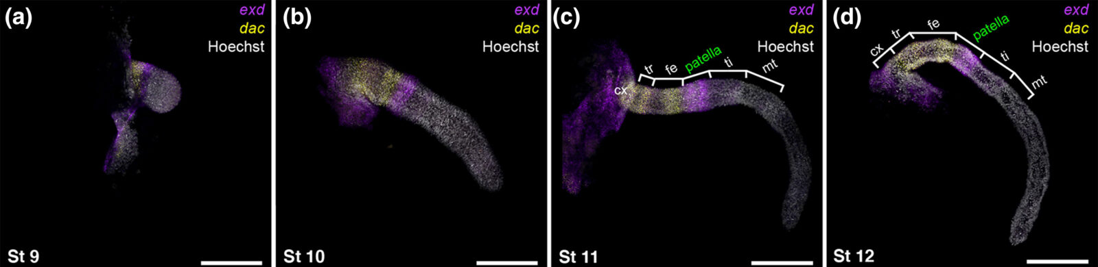 An image of spider legs with various sections fluoresced in magenta and yellow.